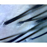 MICROS | Mikroskop | Micros Hand-Held Microscope-HDM200-HAM200 - 1